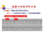 [SCC2011]起搏心电图阅读与分析（下）